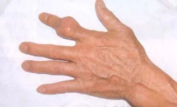 肚子大的一定要认真看！